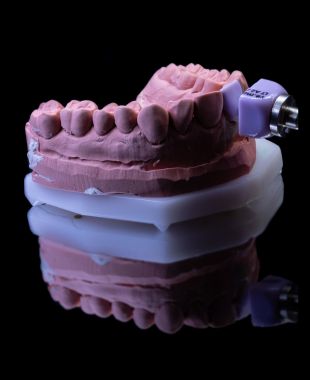 Modelo dental protésico elaborado por Juiz Dental