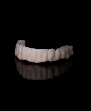 Puente dental cerámico elaborado por Juiz Dental